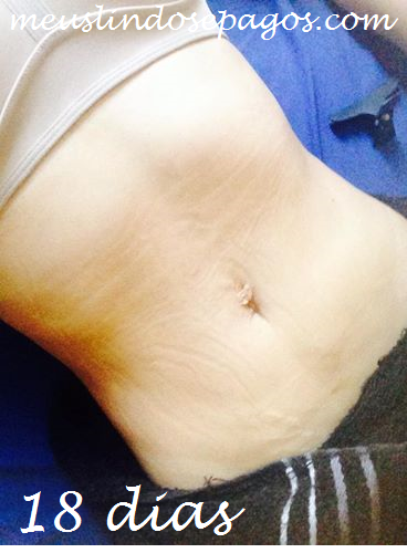 18dias