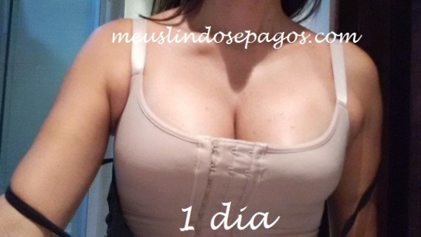 1DIA4