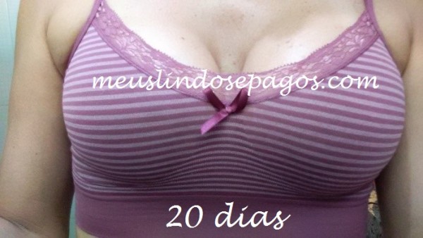 20DIAS2