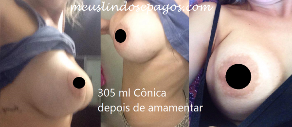 6-depoisde amamentar