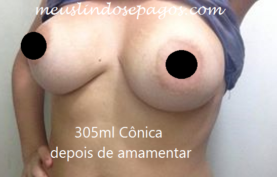 6depois de amamentar