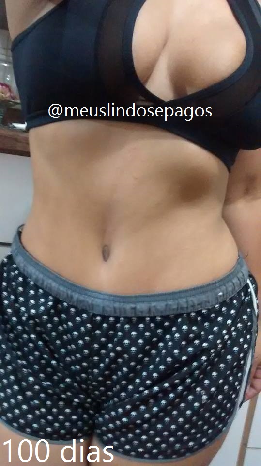 100dias