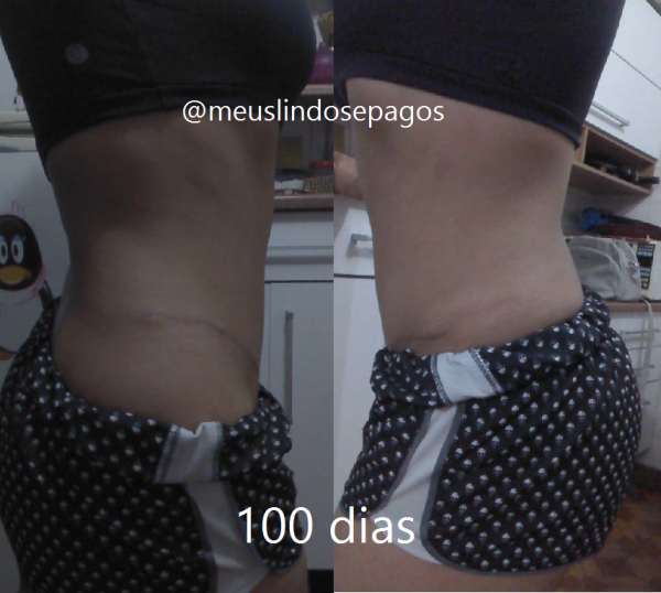 100dias5
