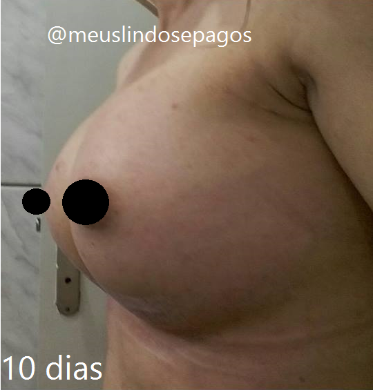 10dias2