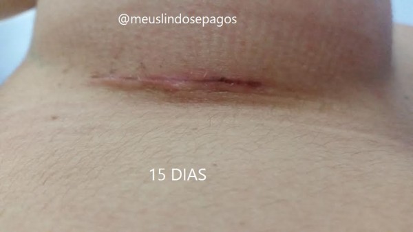 15dias