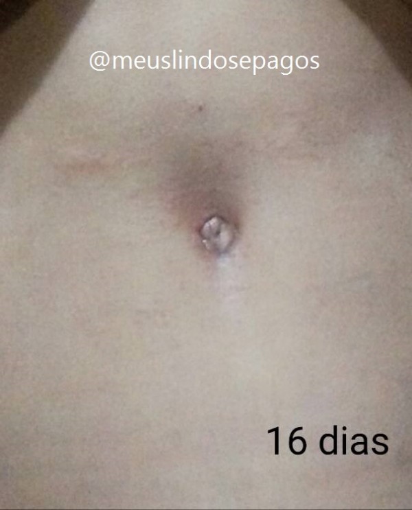 16dias1