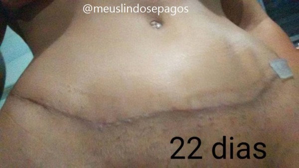 22dias