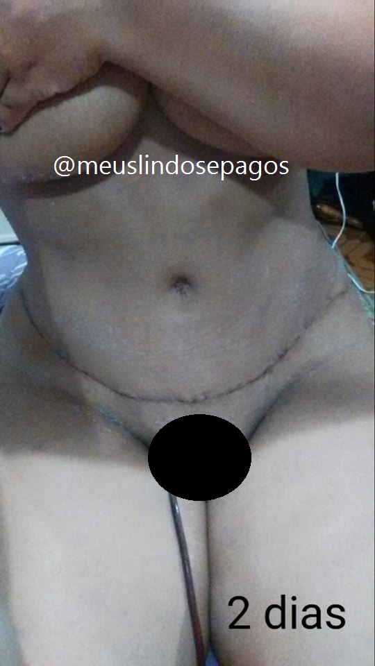 2dias