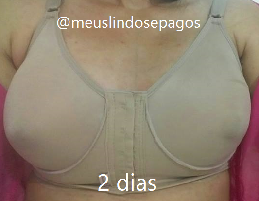 2dias1