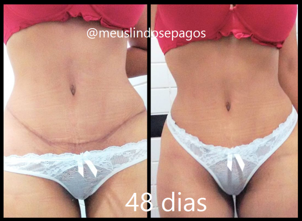 48dias2