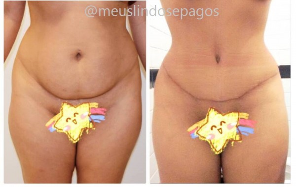 54dias1