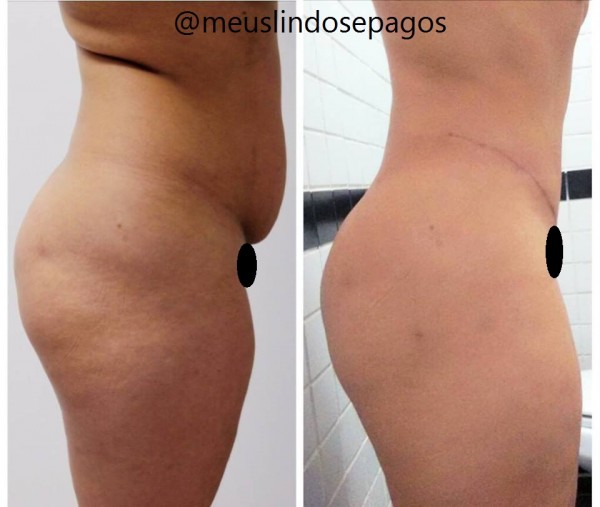 54dias2