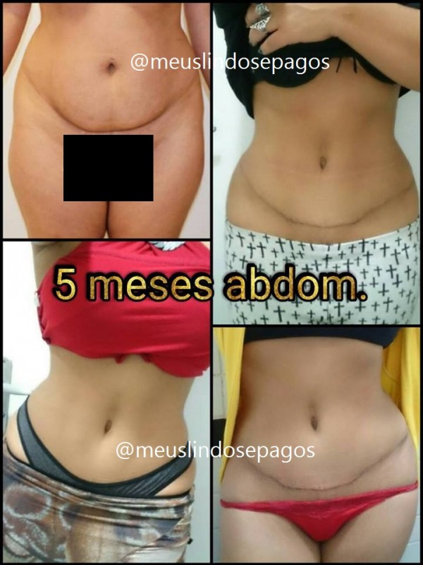 5meses