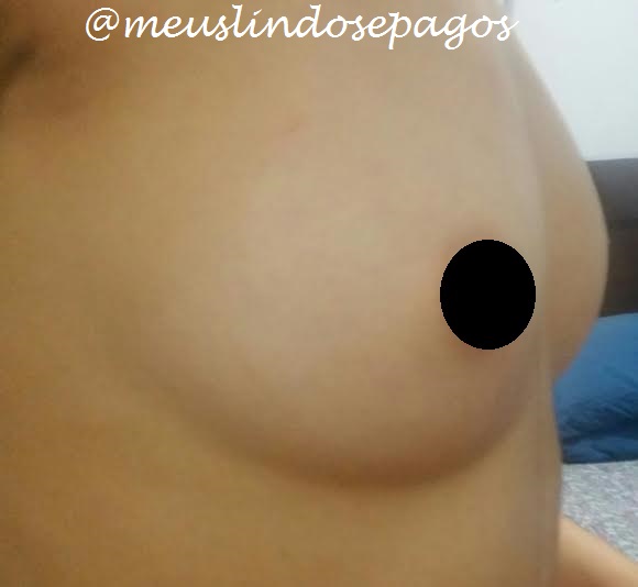 antes1