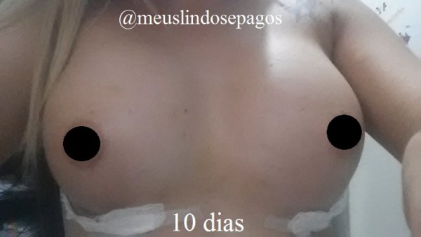10dias-1
