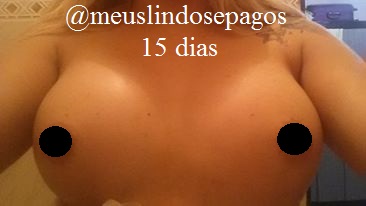 15dias-1