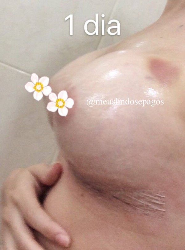 1dia1