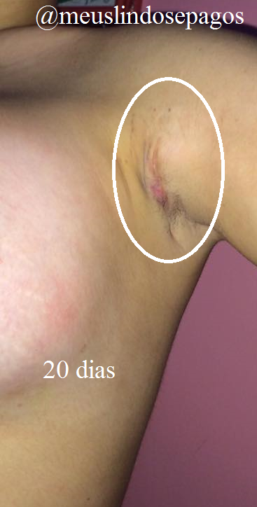 20dias2