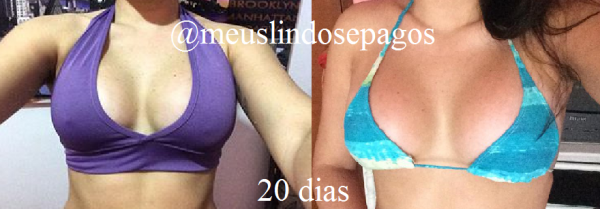 20dias5