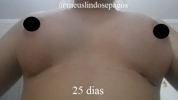 25dias1