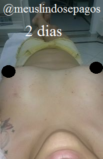 2dias