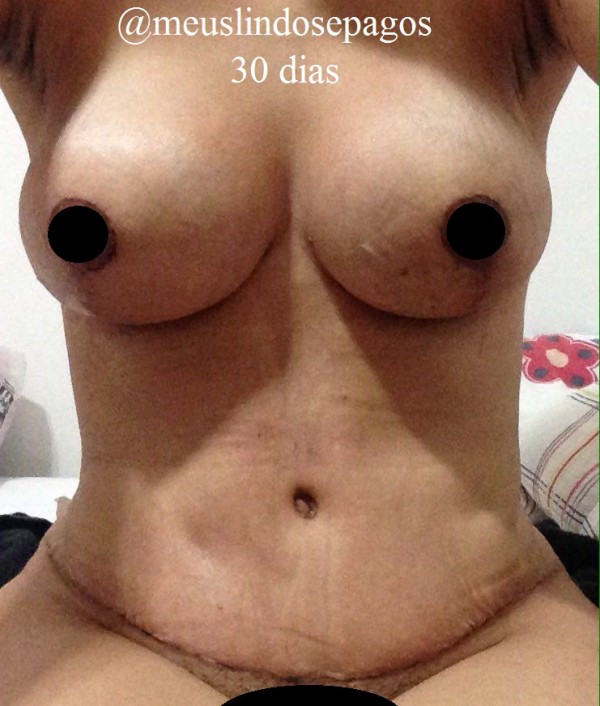 30dias