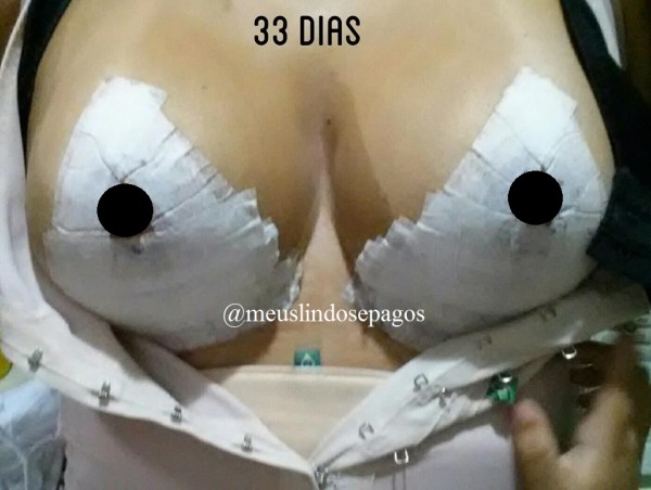 33dias1