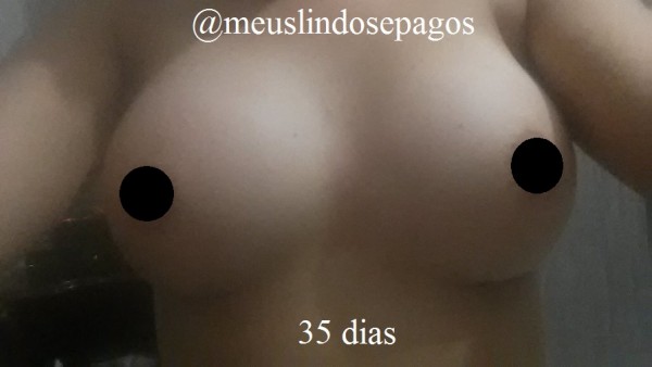 35dias