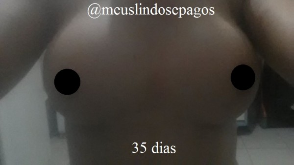 35dias1