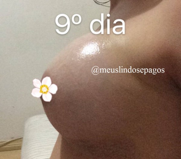 9dias1
