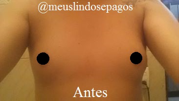 antes-1