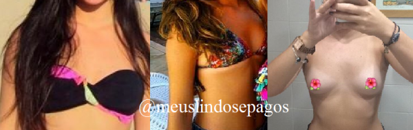 antes5