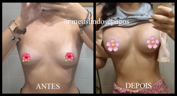montagem
