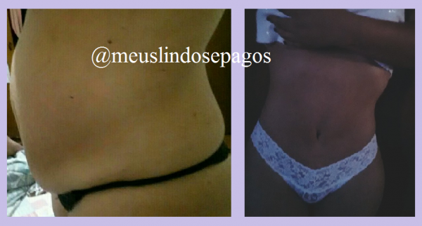 montagem antes e depois