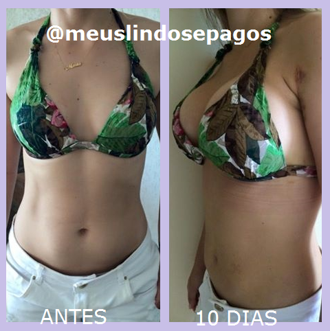 Montagem-Maria Luisa