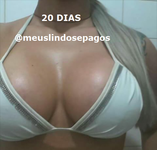 20dias1