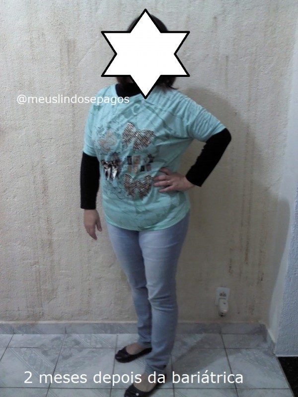 2meses de bariatrica1