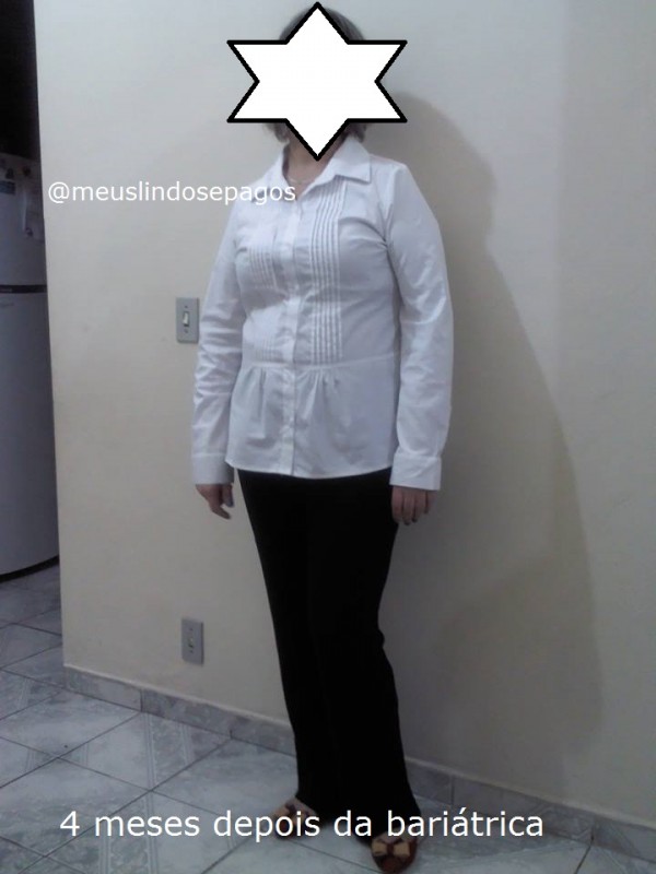 4 meses de bariatrica