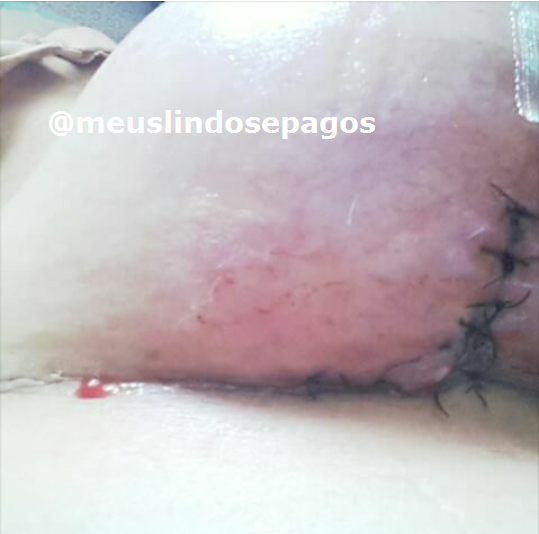 primeira tentativa pra fechar1