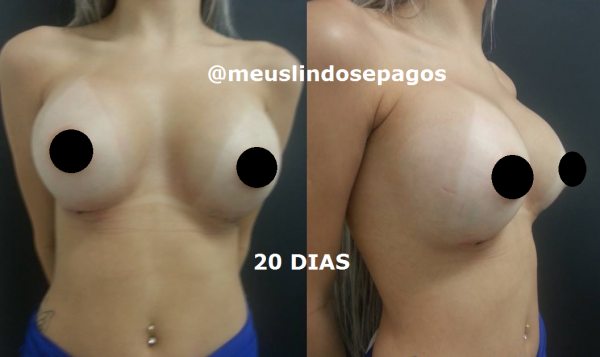 20 DIAS1
