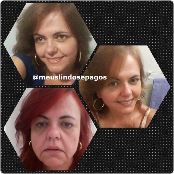 antes e depois