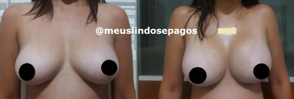 antes e depois2