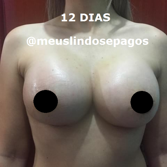 12DIAS