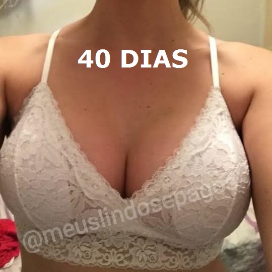 40DIAS