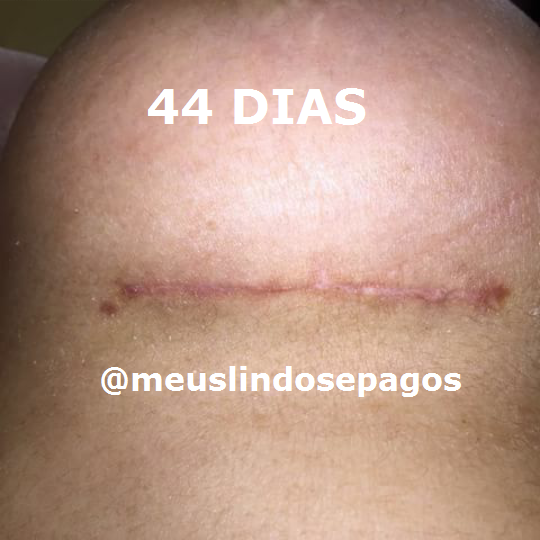 44dias