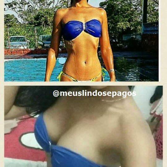 antes e depois1