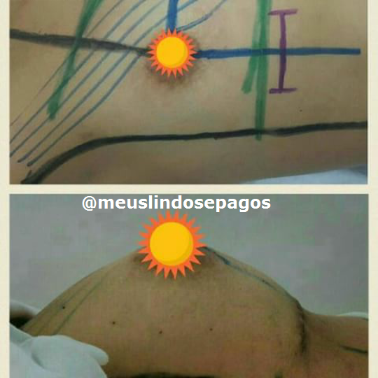 antes e depois2