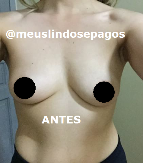 antes1