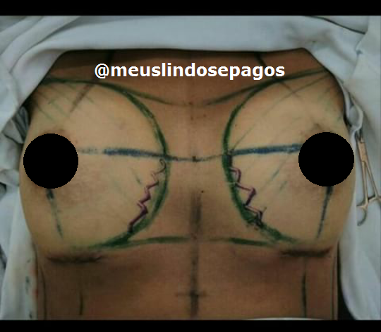 depois