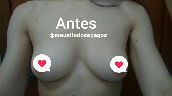 antes